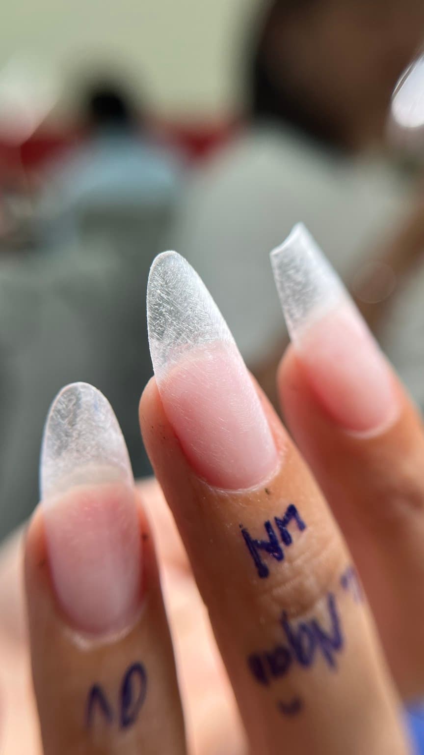 Kỹ thuật Gel X